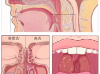 咽喉炎和咳嗽的常见原因及预防策略