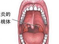 咽喉炎和咳嗽的常见原因及预防策略